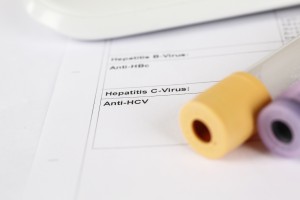 Laboratory test, Hepatitis C, blood tubes on paper